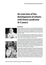 Load image into Gallery viewer, An Overview of the Development of Infants with Down Syndrome (0-5 years) - PDF Ebook
